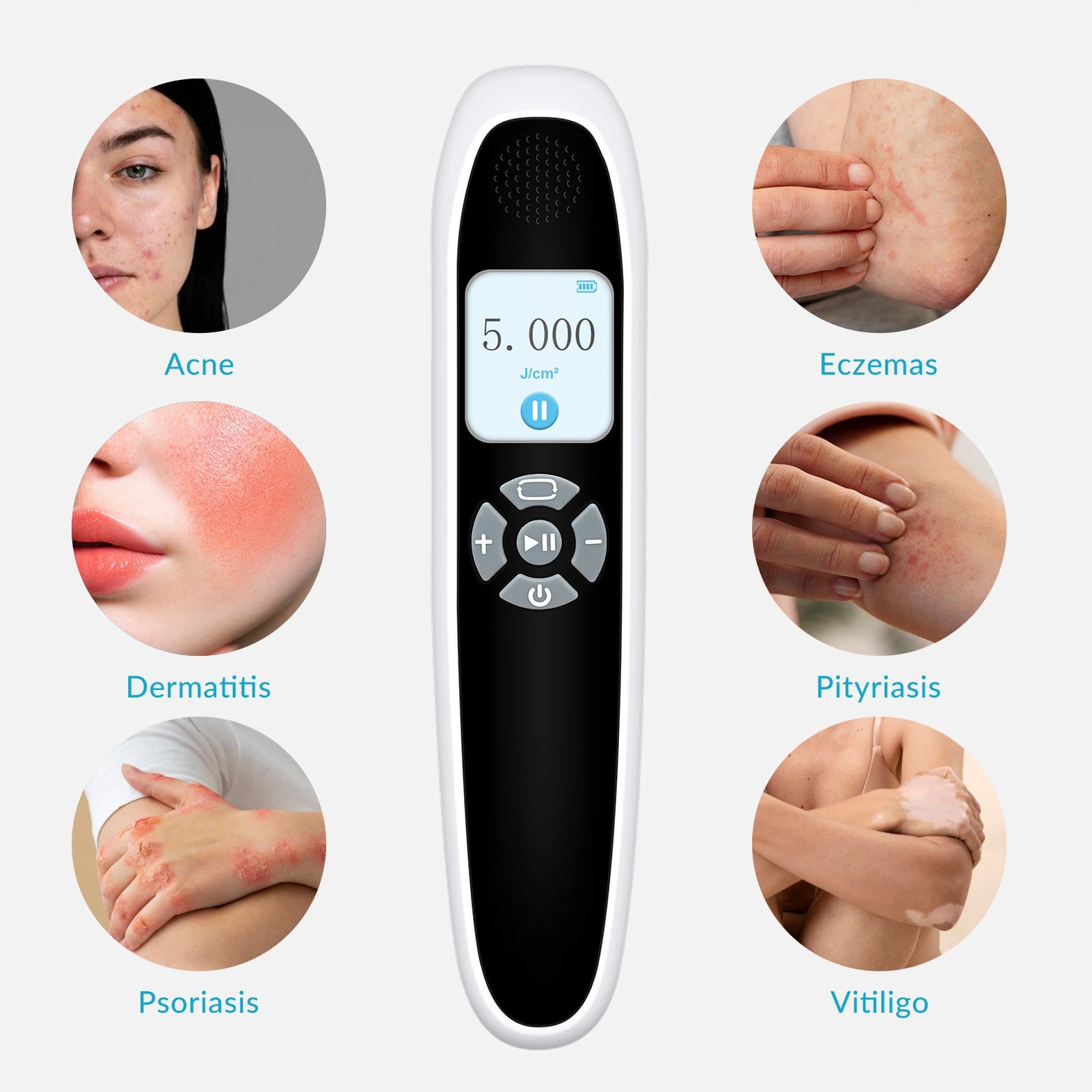 308nm for Skin Diseases – ZJZK Shop